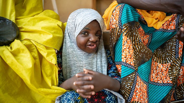 Sakina ist erst vier Jahre alt und hat bereits drei Operationen hinter sich. Dennoch erlebt sie immer noch häufige Rückfälle aufgrund Mangelernährung und schlechter Lebensbedingungen.