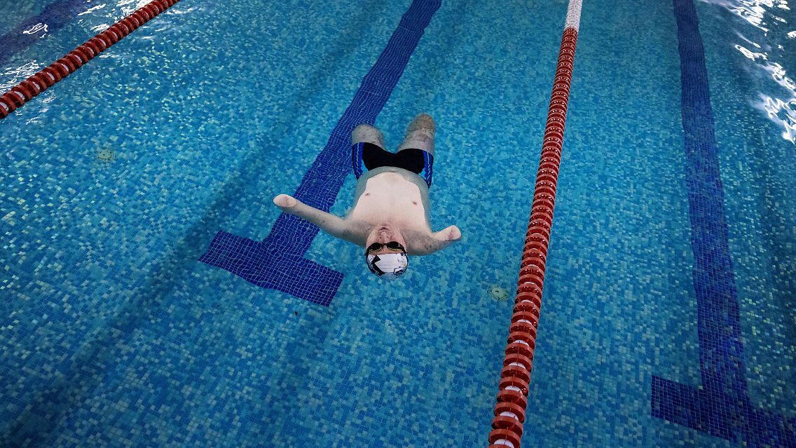 Seine beiden Töchter, die in Berlin leben, nennen ihn "Robodad", weil es sich drei bionische Gliedmaßen einsetzen lassen will.