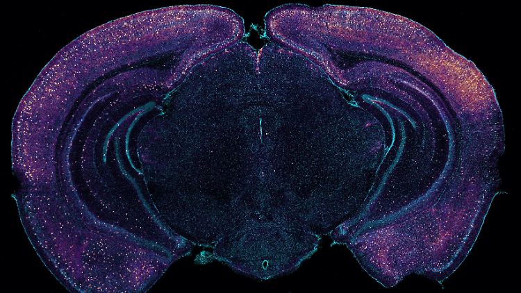 Neuronen im koronalen Querschnitt eines Mäusegehirns
