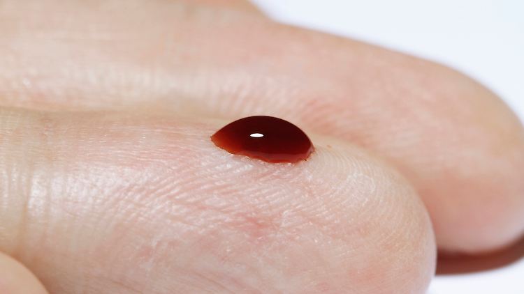 Das Blut für den Krebs-Test muss weder gekühlt noch vakuumiert und kann mehrere Tage aufbewahrt werden.