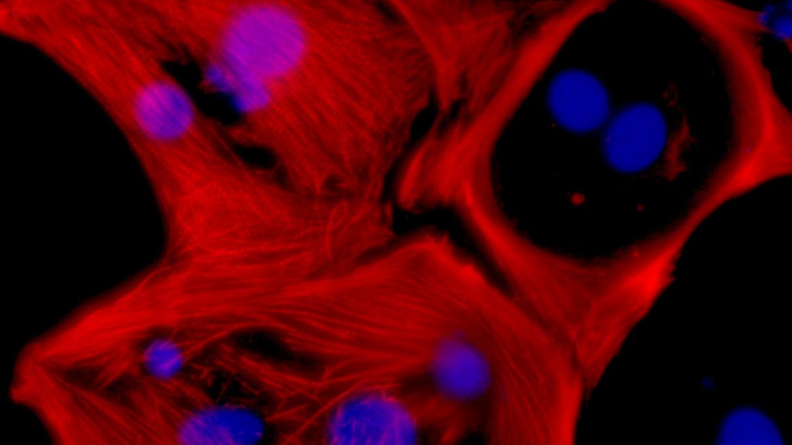 Herzmuskelzellen in einer Laborkultur. Das blaue sind die Zellkerne, rot markiert ist das Troponin T, ein Protein der Herzmuskelzellen.