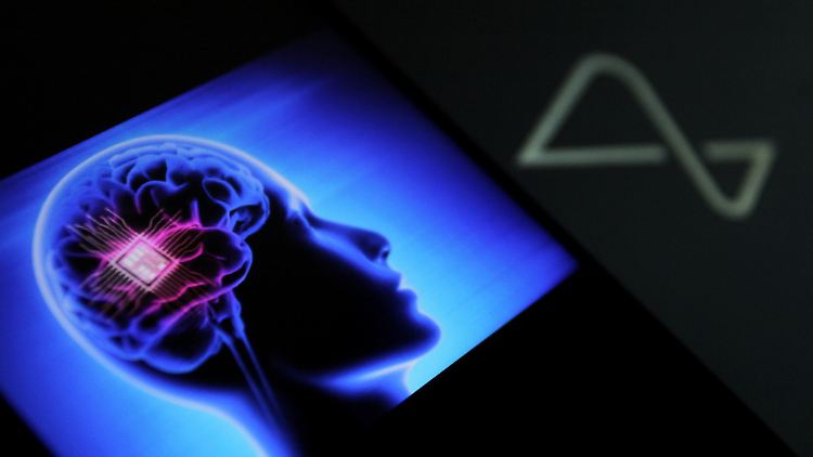 Dem Unternehmen zufolge kann der erste Patient mit dem Neuralink-Implantat inzwischen unter anderem im Internet surfen sowie Schach und das Videogame "Mario Kart" spielen.