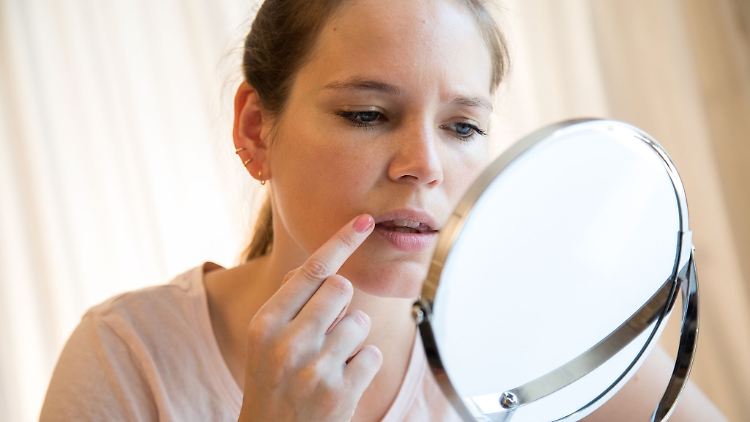 Wer unter Herpes leidet, ist stets auf der Suche nach einem wirk­samen Mittel. 