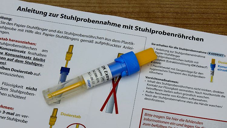 In einigen Laboren kann man sein Stuhl auf eigene Kosten untersuchen lassen. Der Nutzen der Ergebnisse ist allerdings umstritten. 