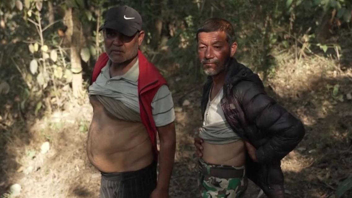 Nepal_Nieren.JPG