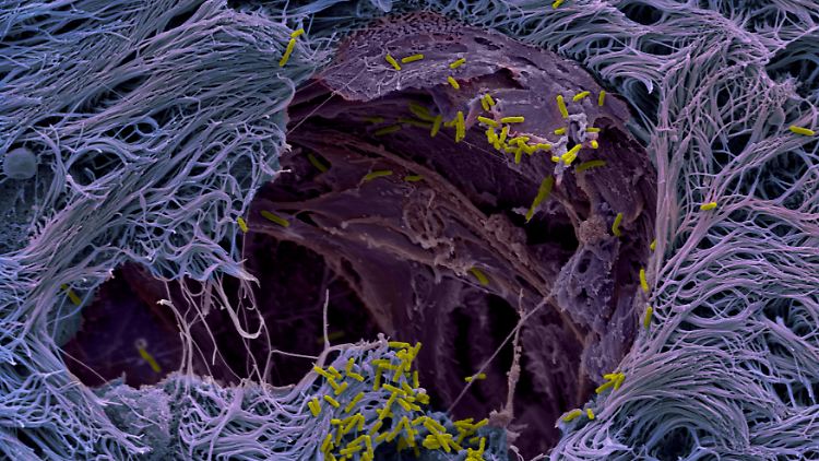 Das Bild, das mit einem Rasterelektronenmikroskop erstellt wurde, zeigt wie Pseudomonas aeruginosa das respiratorische Epithel eines menschlichen Lungenmikrogewebemodells durchdringt.