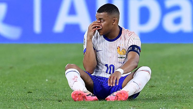 Diagnose Nasenbeinbruch: Frankreichs Kylian Mbappé hat es erwischt.