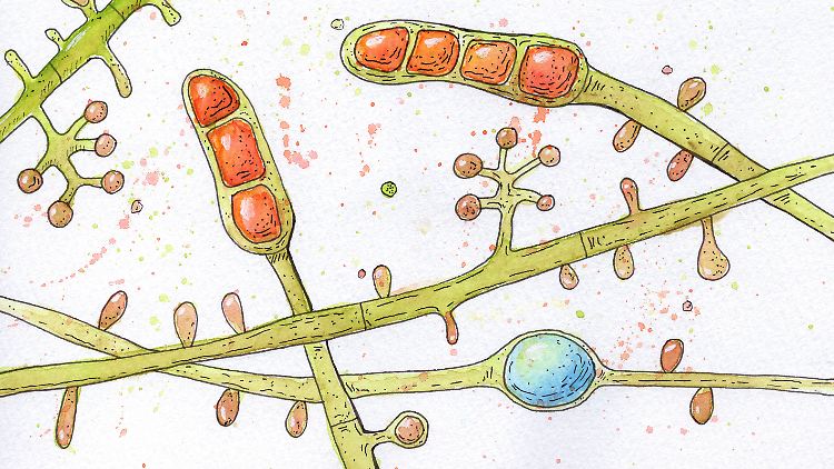 Alleine in seinem Labor labopart seien 2023 fast 350 Nachweise des Hautpilzes Trichophyton tonsurans gelungen, berichtet der Dermatologe Pietro Nenoff. 