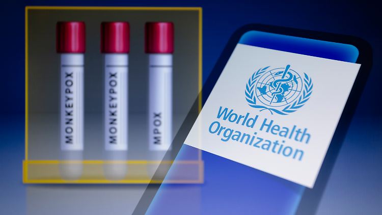 Die WHO schaut mit großer Sorge auf die Ausbreitung der Mpox-Viren. 