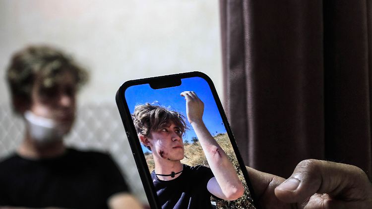 Einer der Freiwilligen zeigt ein Foto seiner Verletzungen unmittelbar nach dem Angriff. 