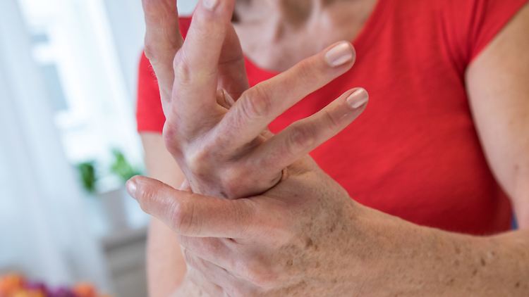 Von Arthrose sind am häufigsten Knie- und Hüftgelenk betroffen. Doch auch an den Händen kann es zu Knorpelverschleiß kommen. 