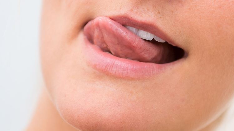 Bei einer Glossodynie sind meist die vorderen zwei Drittel der Zunge betroffen, die Ränder und die Spitze. Brennen auch Gaumen, Wangen und Mundschleimhaut, sprechen Fachleute vom Burning-Mouth-Syndrom.