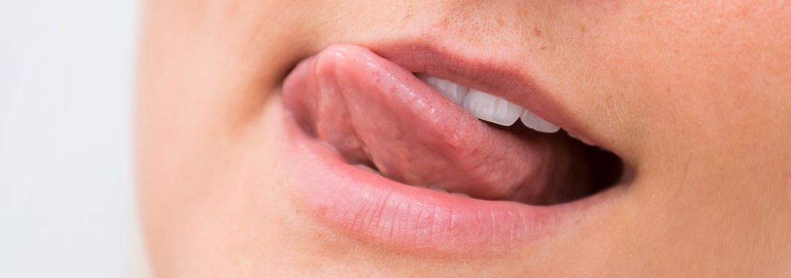Unangenehm: Bei einer Glossodynie sind meist die vorderen zwei Drittel der Zunge betroffen, die Ränder und die Zungenspitze.jpg