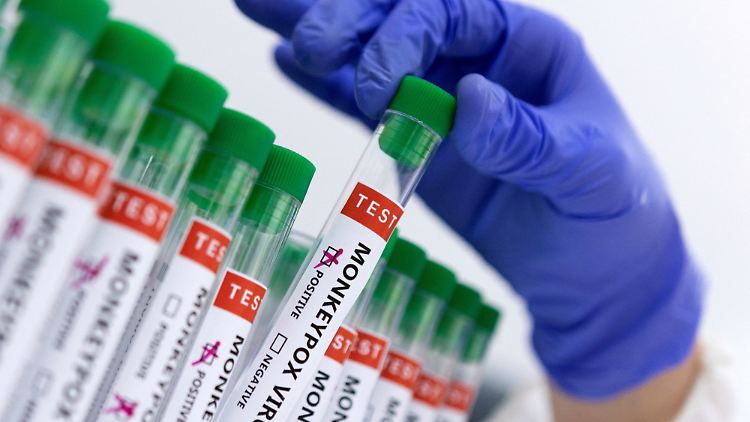 Vor zwei Jahren wurden die Affenpocken in Mpox umbenannt.