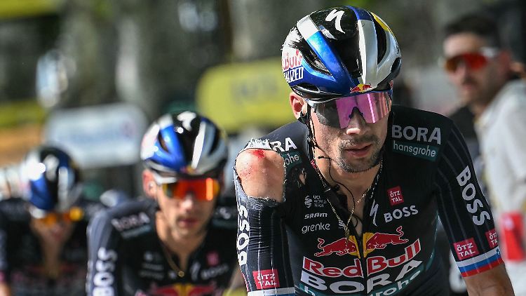 Primoz Roglic war nach seinem Sturz bei der Tour de France schwer gezeichnet.