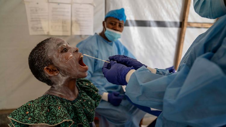 Kinder unter 15 machten in diesem Jahr 56 Prozent aller Mpox-Fälle und 79 Prozent aller Todesfälle aus.