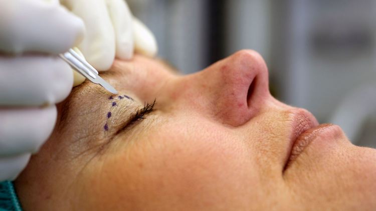 Deutsche Krankenkassen übernehmen meist keine Folgekosten für misslungene Eingriffe, weshalb sorgfältige Auswahl und eine gute Absicherung entscheidend sind.