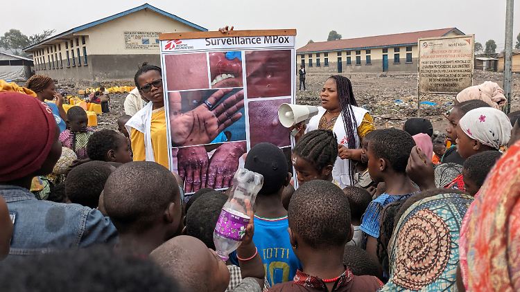 Gesundheitshelfer klären Kinder in Goma im Kongo über die Symptome der Mpox-Krankheit auf.
