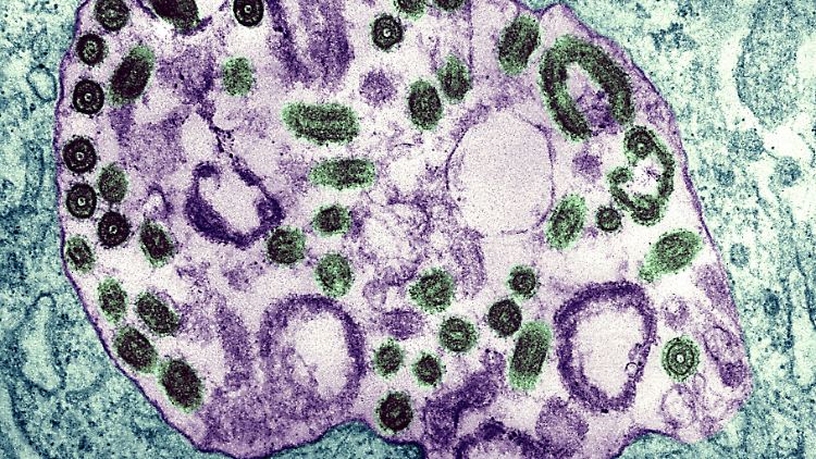 Das Virus wurde erstmals 1967 bei Ausbrüchen unter anderem in der hessischen Stadt Marburg beschrieben.