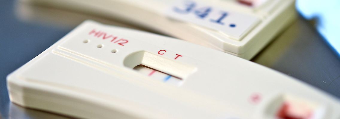 HIV-Schnelltests zeigen an, ob jemand das Virus in sich trägt. (Archivbild)