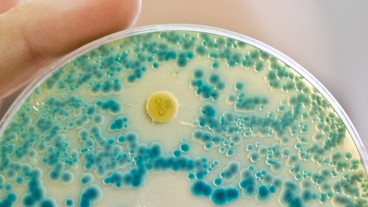 In der EU sterben jährlich 35.000 Menschen an antibiotikaresistenten Erregern.