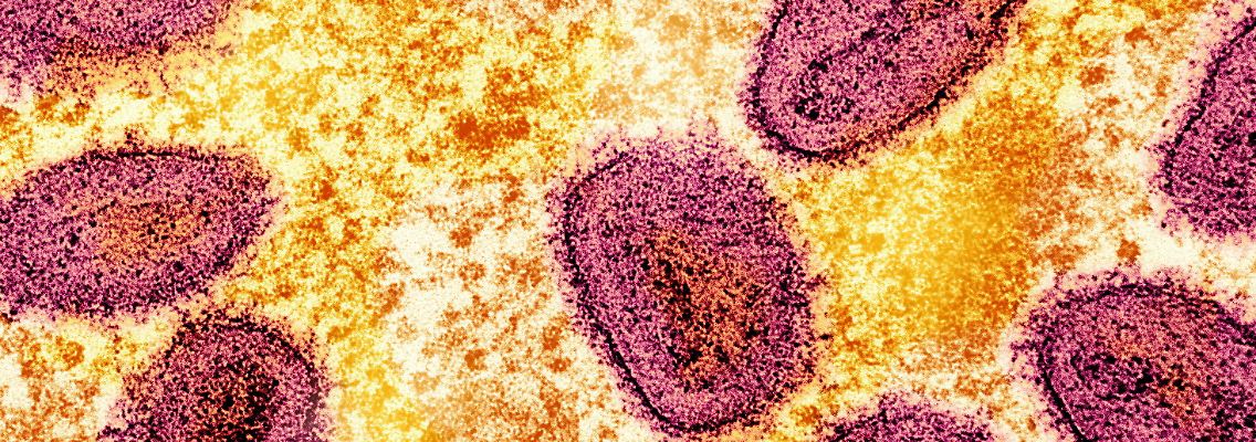 2024-10-14T065558Z_875552388_RC2WN1A0YR35_RTRMADP_3_HEALTH-MPOX-VACCINE.JPG