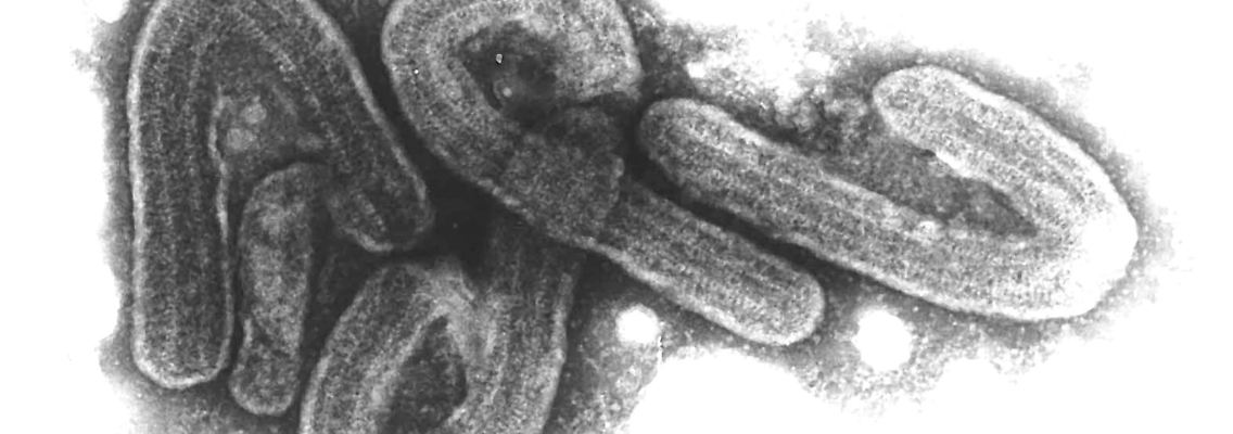 Elektronenmikroskopische Aufnahme des Marburg-Virus. Das Marburg-Virus gehört zu den gefährlichsten bekannten Krankheitserregern.