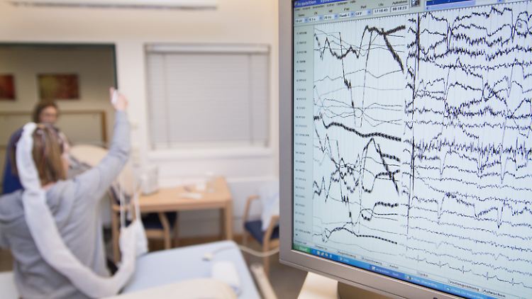 Ein EEG macht Gehirnströme sichtbar. Das Untersuchungs-Verfahren nimmt eine wichtige Rolle in der Diagnostik der Erkrankung Epilepsie ein.