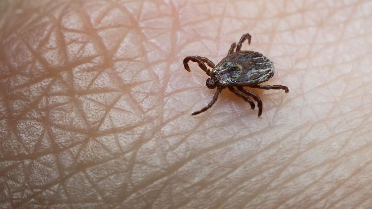 Großaufnahme einer Zecke auf menschlicher Haut: Die Insekten übertragen gefährliche Krankheiten und sind in ganz Deutschland aktiv - auch im Winter. 