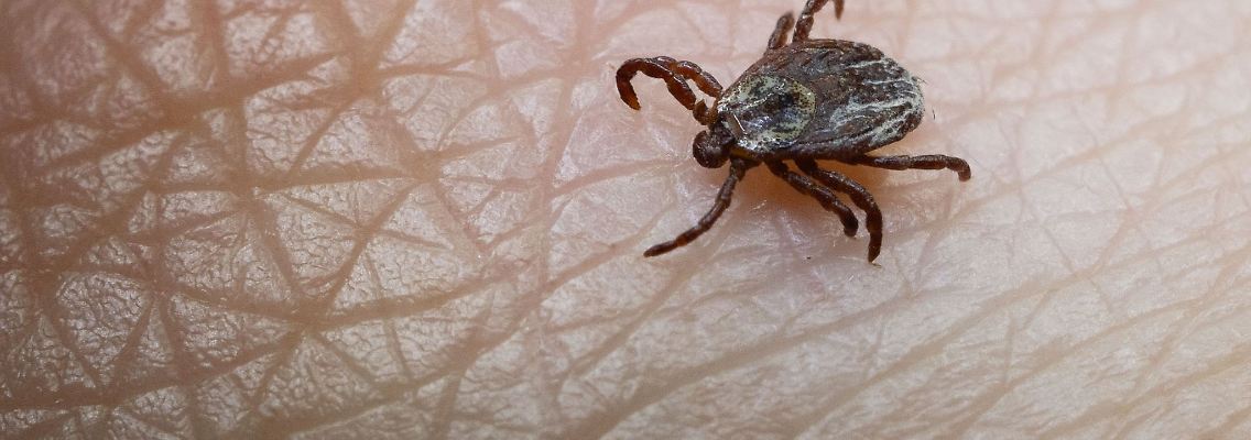 Großaufnahme einer Zecke auf menschlicher Haut: Die Insekten übertragen gefährliche Krankheiten und sind in ganz Deutschland aktiv - auch im Winter.