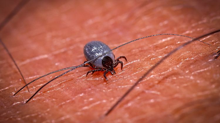 Neben FSME übertragen Zecken auch die von Bakterien verursachte Lyme-Borreliose. 