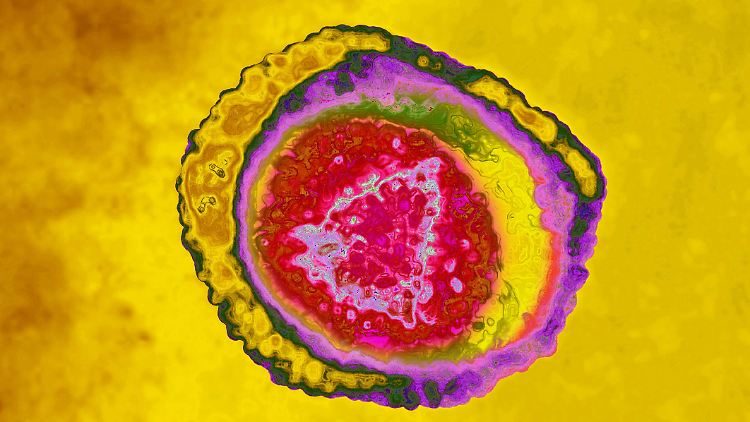 Die Genitalherpes-Erreger nisten sich in den Nervenknoten (Ganglien) am unteren Ende der Wirbelsäule ein. 