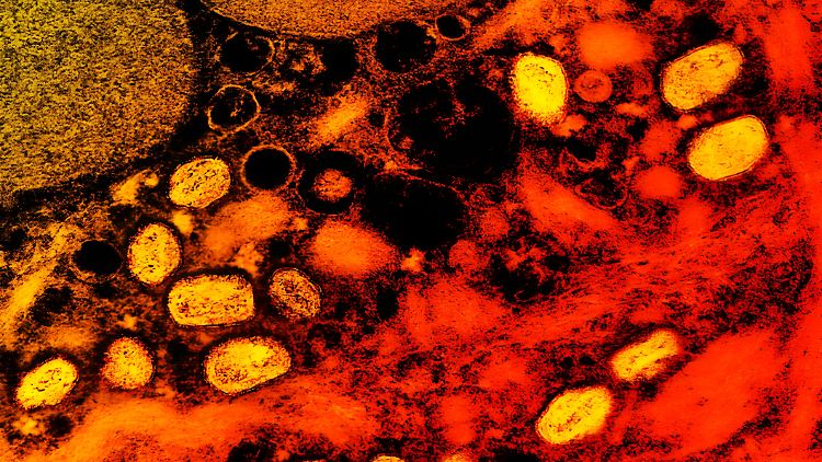 Mpox sind weniger ansteckend als etwa Atemwegskrankheiten, da sie hauptsächlich durch engen Hautkontakt übertragen werden.