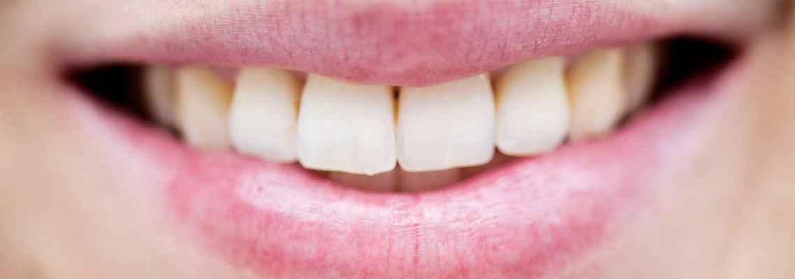 Alle Affen können lachen - aber unter allen Primaten haben nur Menschen eine Sprache herausgebildet.
