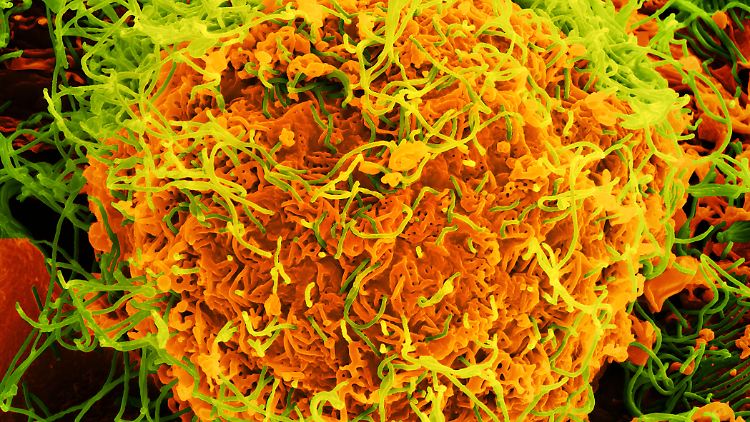 Ebolaviren wurden auch im Schweiß, in der Tränenflüssigkeit, in der Muttermilch und im Sperma nachgewiesen.