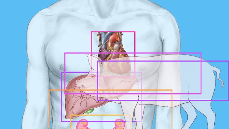 Die genetische Übereinstimmung zwischen Mensch und Schwein liegt bei 95 Prozent. Deshalb müssen die Organe vor der Transplantation genetisch angepasst werden. 
