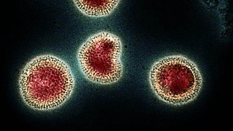 Sowohl Influenza A als auch B können die saisonale Grippe verursachen. Im Gegensatz zum Influenza-A-Virus, das auch Tiere infizieren kann, befällt Influenza B (im Bild) nur Menschen.
