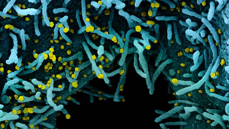 Eine mit dem SARS-CoV-2-Virus infizierte menschliche Zelle unter dem Elektronenmikroskop.