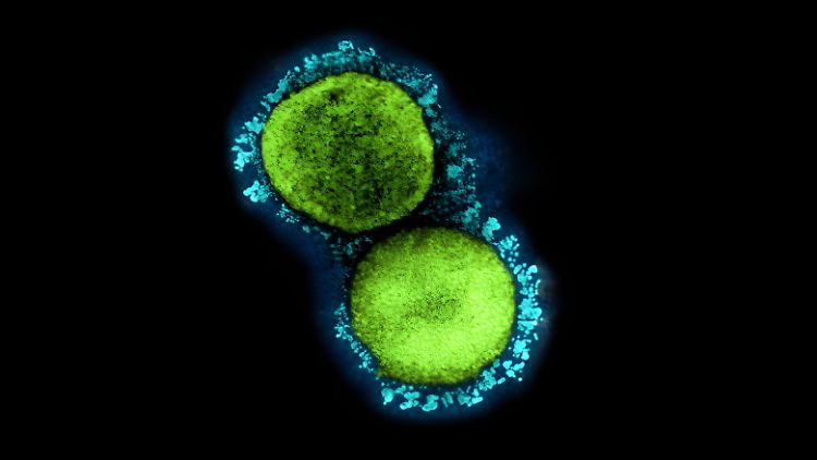 Eine Elektronenmikroskopaufnahme von SARS-CoV-2: Von Wuhan aus verbreitet sich das Virus vor fünf Jahren auf der ganzen Welt.
