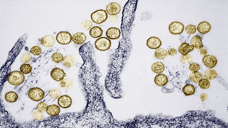 Elektronenmikroskopische Aufnahme des Sin-Nombre-Hantavirus.