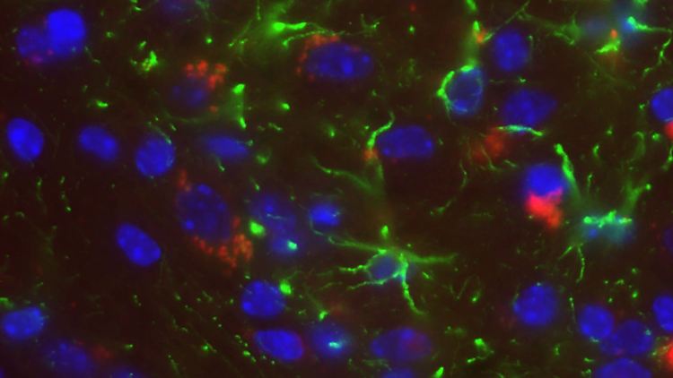 Ein neu entwickelter Antikörper (rot) stoppt die Alzheimer-Krankheit bei Mäusen. Die Studienergebnisse seien ohne Weiteres auf den Menschen übertragbar, hieß es im November 2010. Forscher gehen davon aus, dass die Therapie-Form in spätestens zwei Jahren bei Alzheimer-Patienten einsetzbar ist.