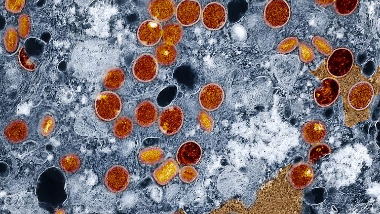 Das Mpox-Virus kann von Mensch zu Mensch übertragen werden. 
