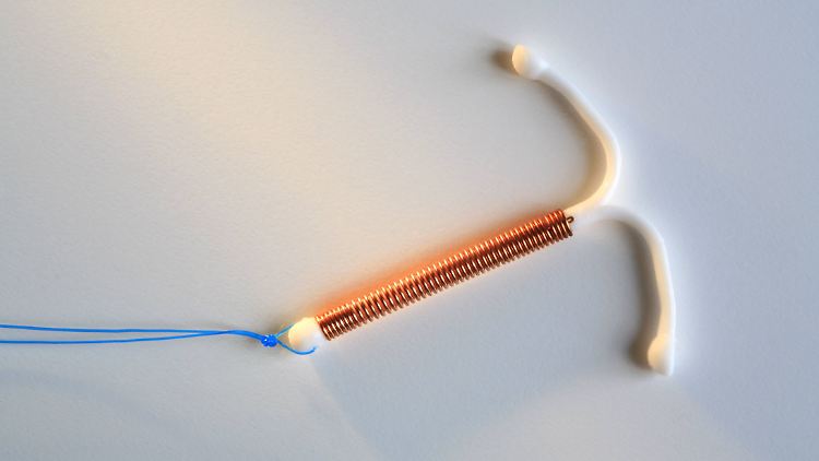 Die Spirale der Frau stammte aus einer Charge, bei der Materialfehler festgestellt wurden.