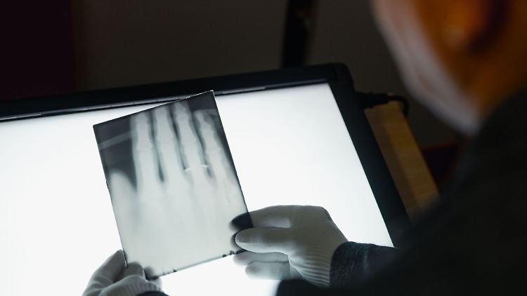 Ein Röntgenbild der Hand von Wilhelm Röntgen gehört nun zum  Unesco-Weltdokumentenerbe. (Das in der früheren Version des Beitrags
abgebildete Gerät steht in keinem Zusammenhang mit dem Röntgenreport 2025.)