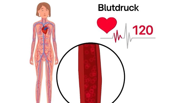 blutdruck.jpg
