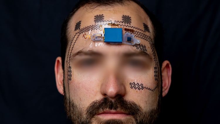 Noch ist das E-Tattoo auf haarlose Bereiche beschränkt, was die Überwachung bestimmter Gehirnregionen erschwert.
