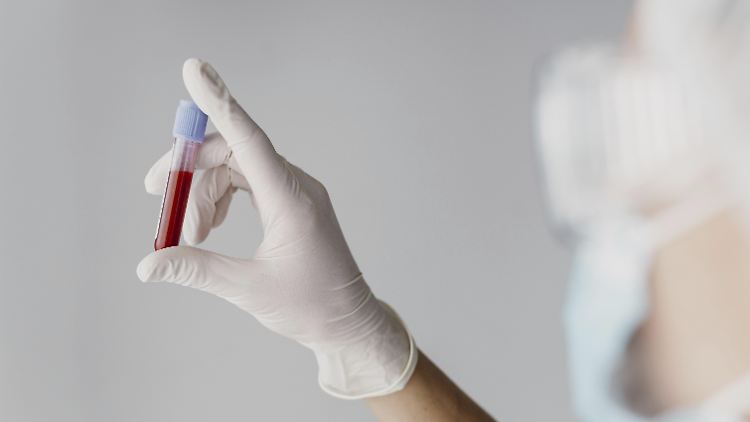 Der neue Bluttest könnte dazu beitragen, Menschen mit einem erhöhten MS-Risiko frühzeitig zu identifizieren.