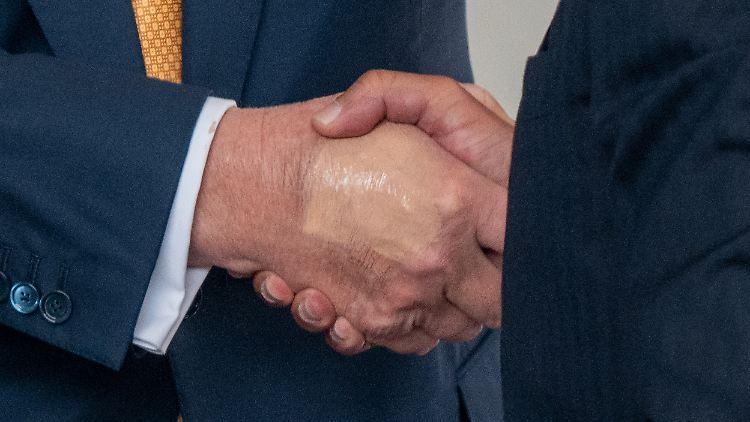 Make-up an einer Hand Trumps, das offensichtlich einen blauen Fleck überdecken sollte, sorgte in jüngster Zeit für Aufregung.