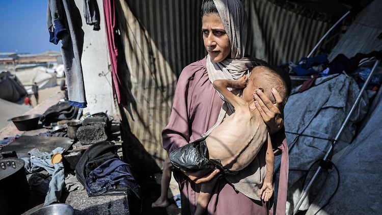Einer von zwei Millionen Hungernden in Gaza: der anderthalbjährige Muhammad Zakariya aus Gaza ist lebensbedrohlich unterernährt
