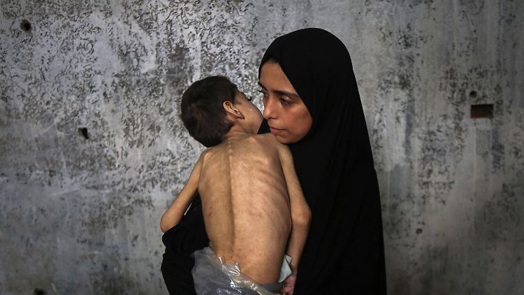 Ein vertriebenes palästinensisches Kind, das an Unterernährung und zerebraler Lähmung leidet, in einer zur Schule umfunktionierten Unterkunft im Nordwesten von Gaza-Stadt.